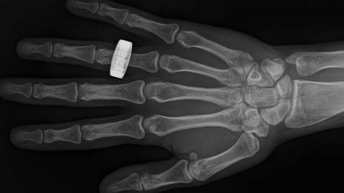 Behold: The First Medical X-rays Ever Taken in Space