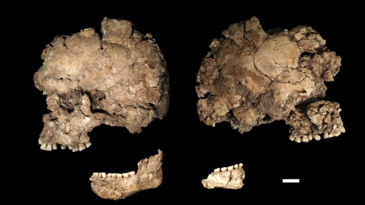 This Early Human Was Stabbed in the Face—and Recovered