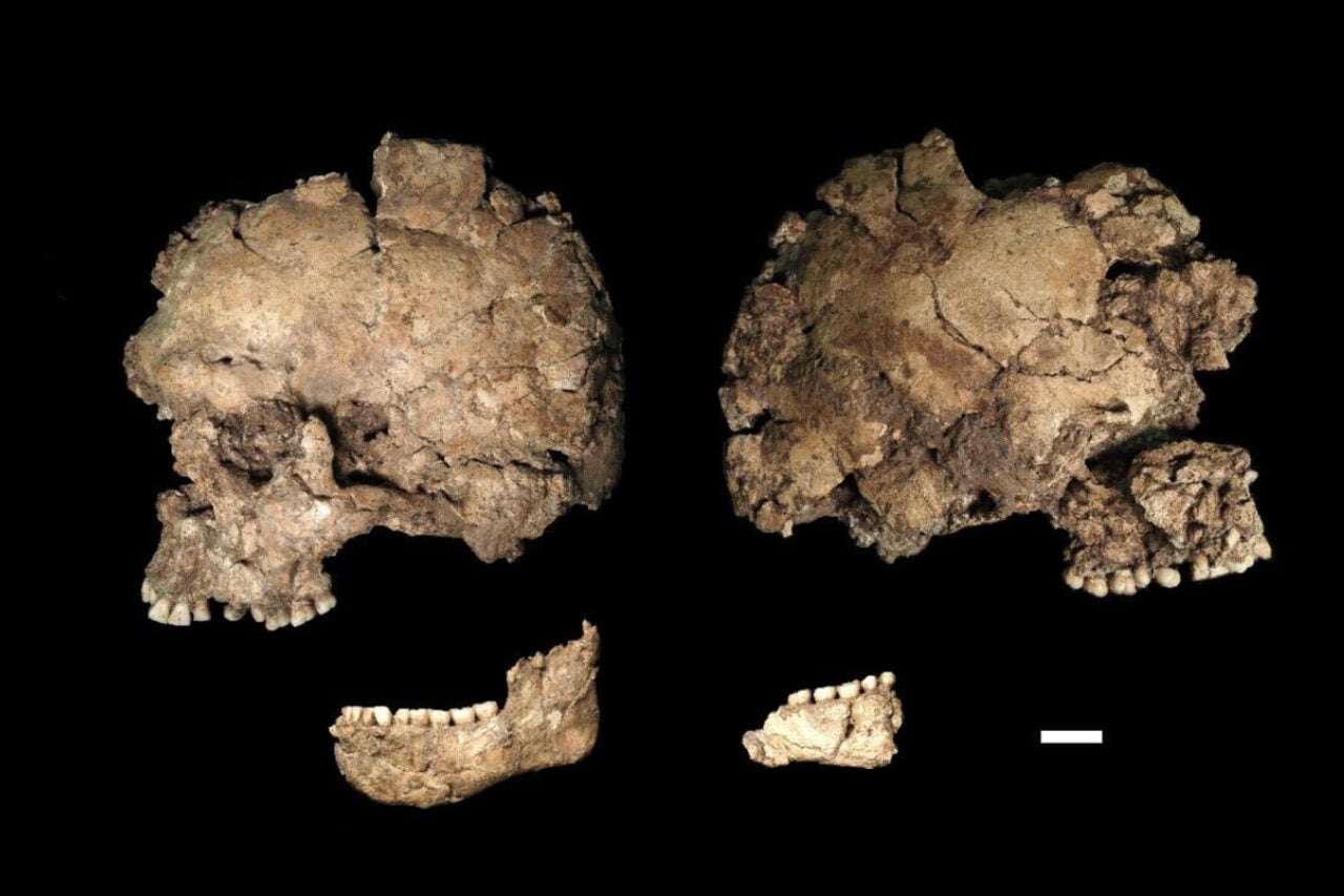 This Early Human Was Stabbed in the Face—and Recovered