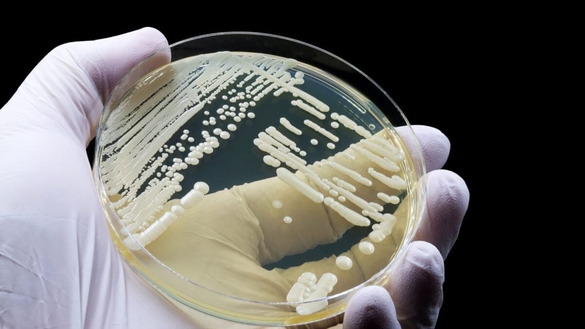This Deadly Drug-Resistant Fungus Can Lurk in Your Skin. Scientists Just Discovered How This Deadly Drug-Resistant Fungus Can Lurk in Your Skin. Scientists Just Discovered How