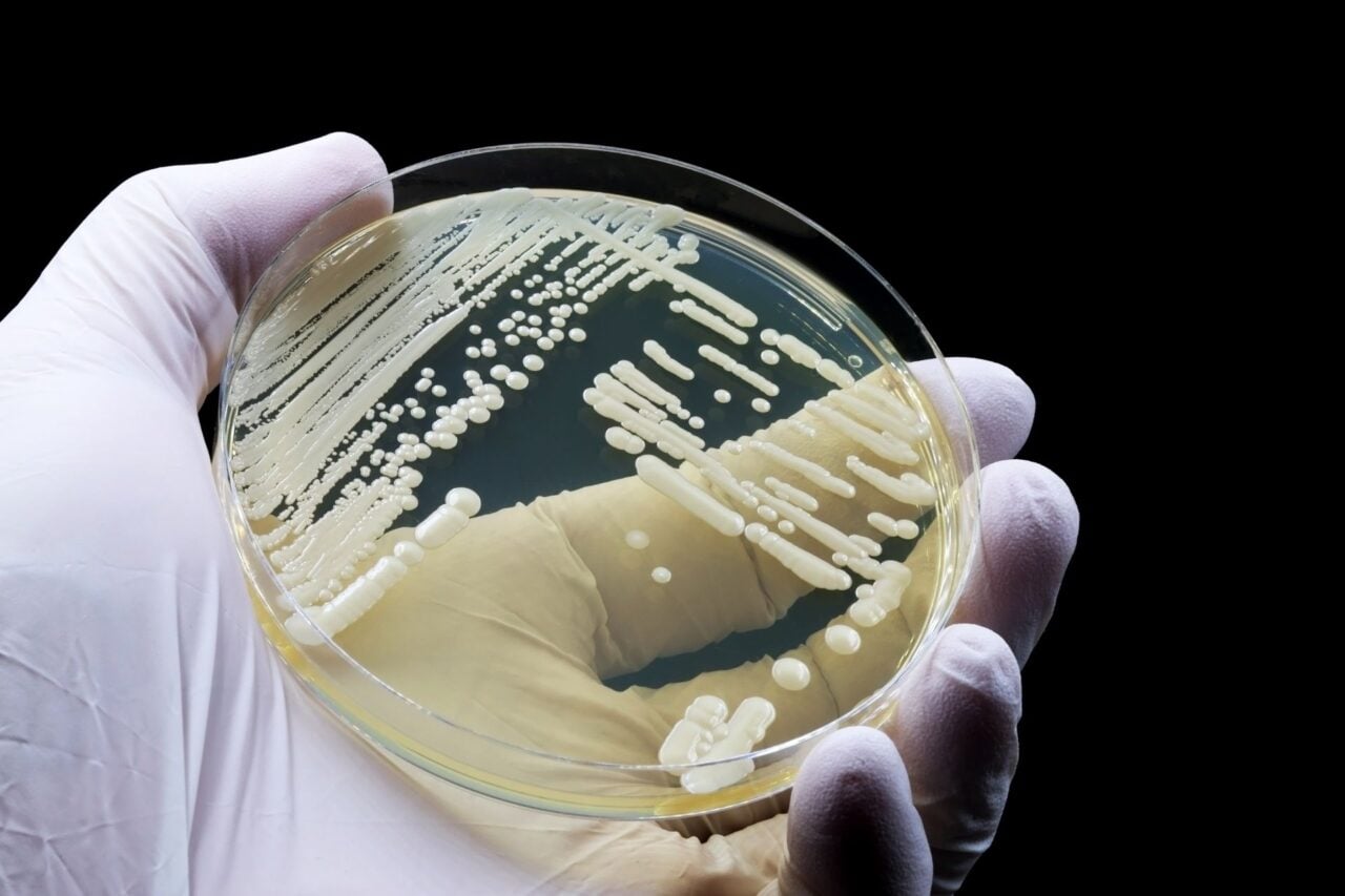 This Deadly Drug-Resistant Fungus Can Lurk in Your Skin. Scientists Just Discovered How