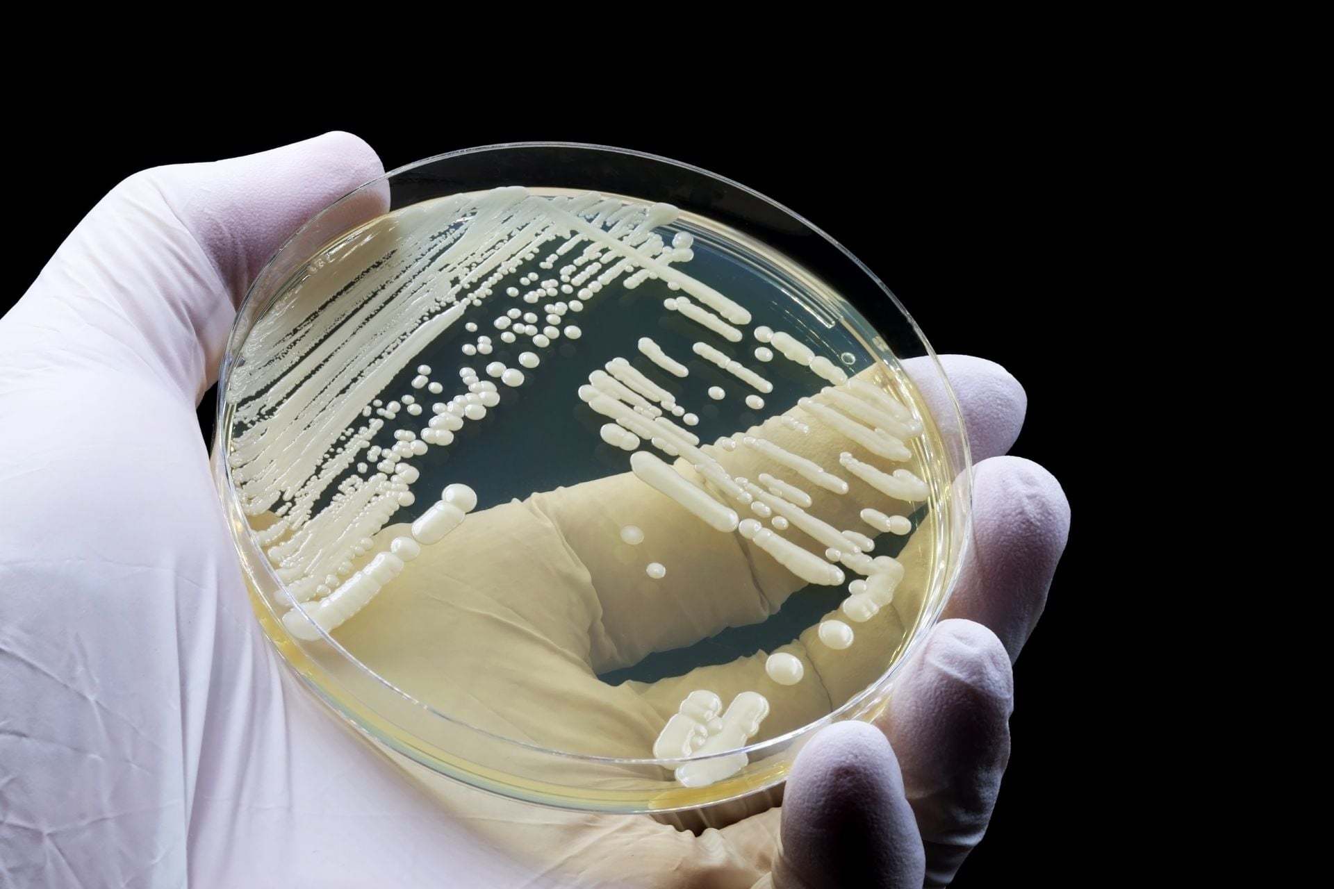 A culture of the fungus Candida auris.