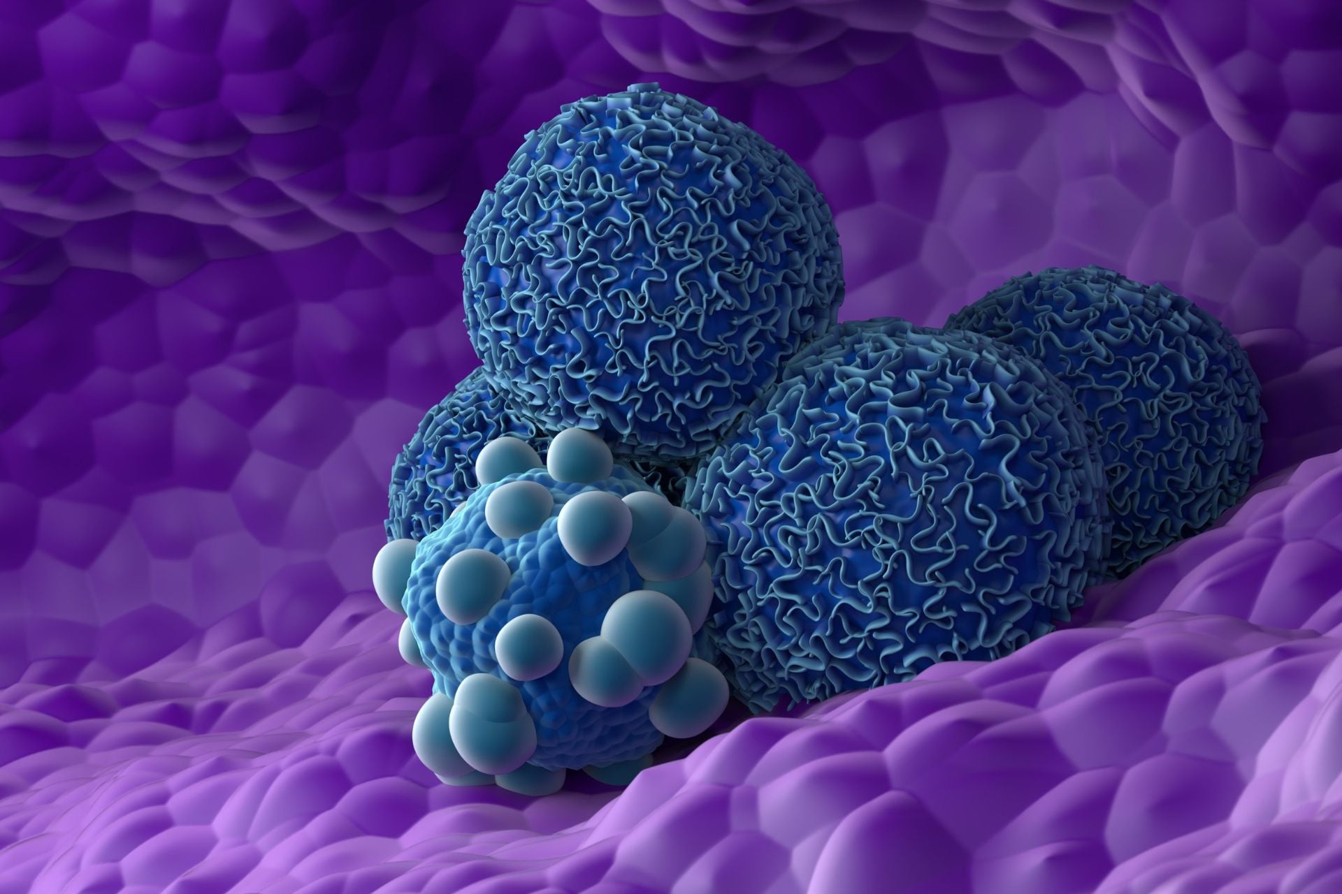 An illustration of pancreatic cancer cells.