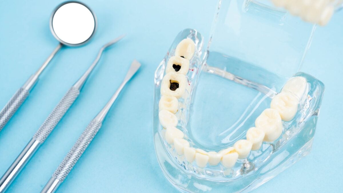Liquid Fluoride Can Stop Cavities Without Drilling, Major Trial Finds Liquid Fluoride Can Stop Cavities Without Drilling, Major Trial Finds