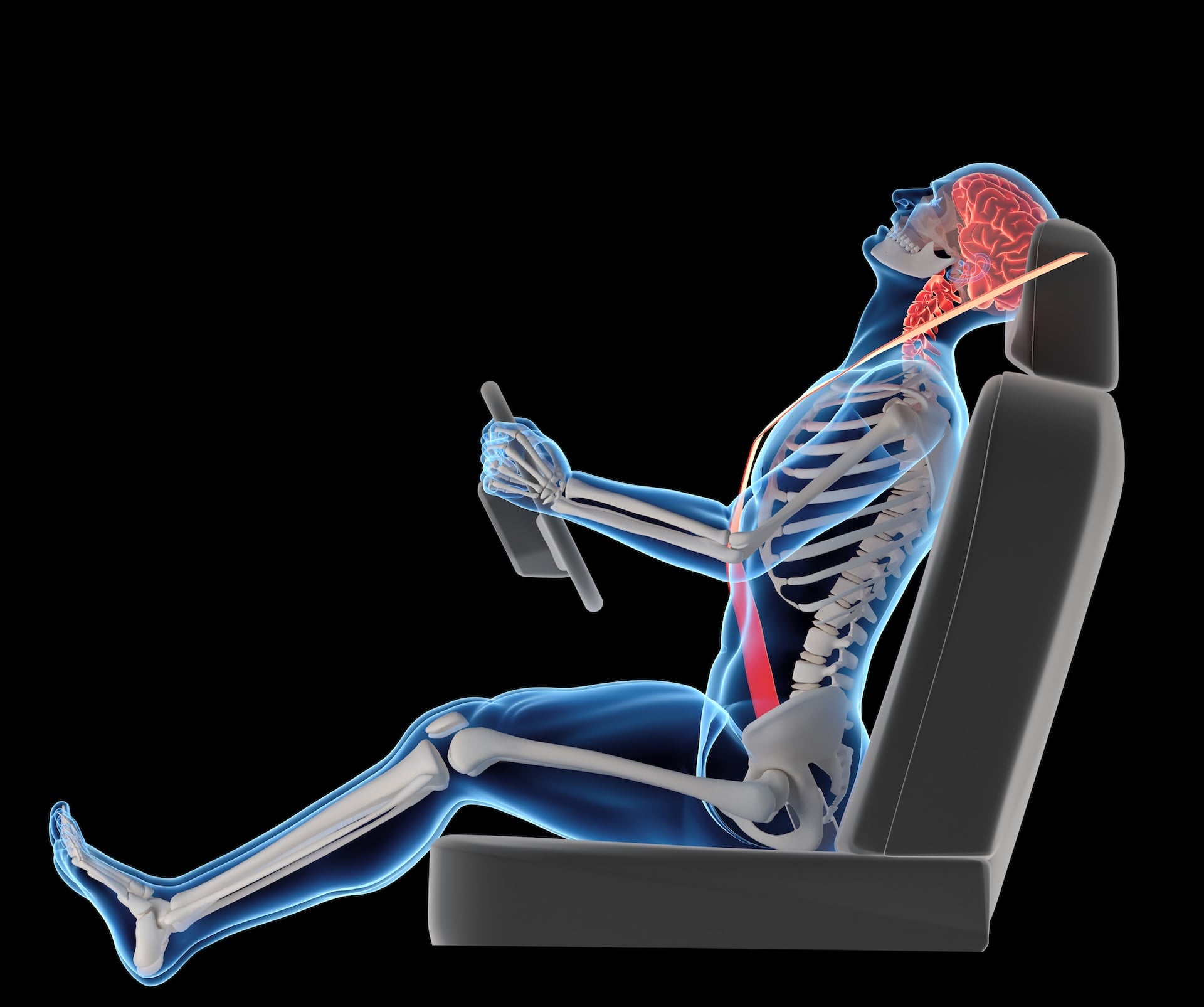 Whiplash (artist's rendering)