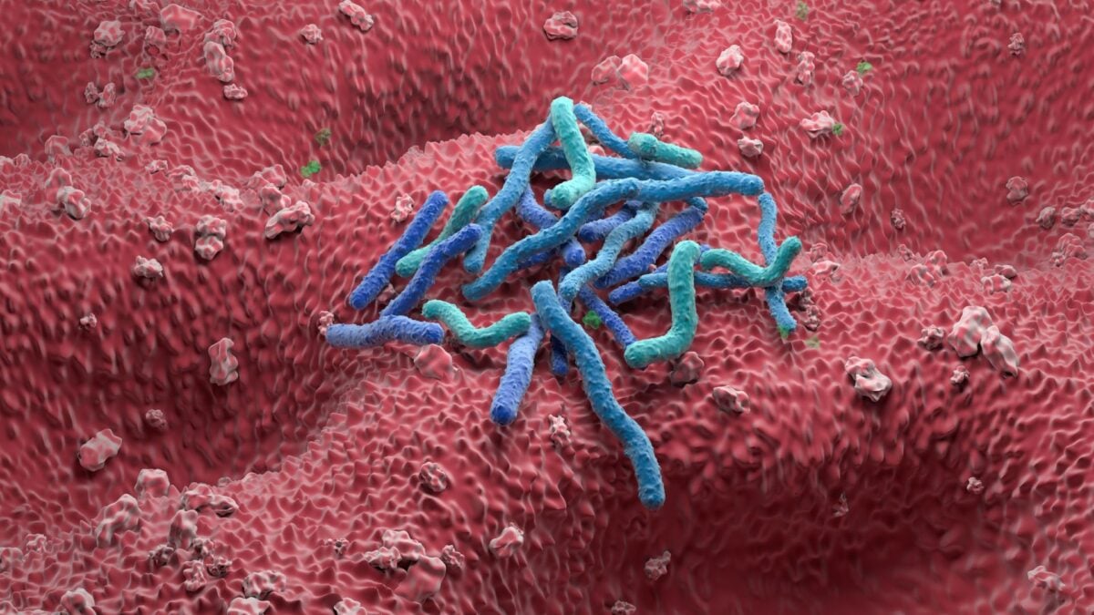 Sep 30 1:25 pm 1 in 8 Cancers Are Caused by Infections. The Biggest Culprit Isn’t HPV Ed Cara