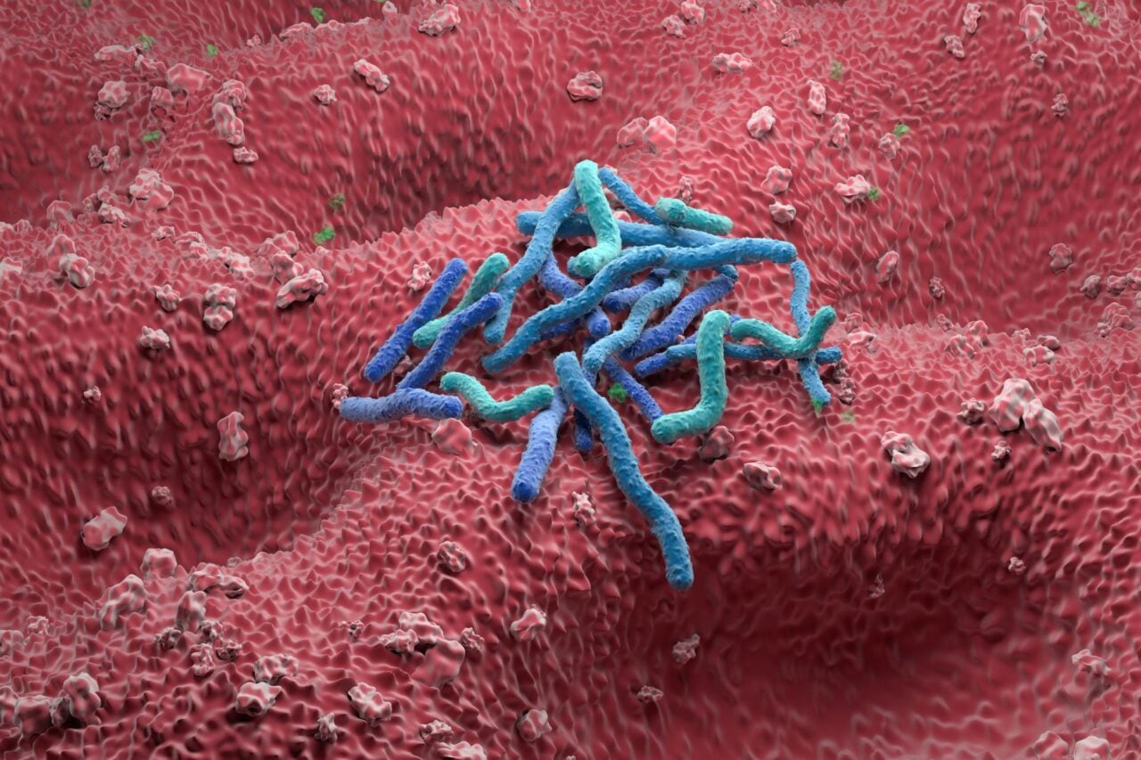1 in 8 Cancers Are Caused by Infections. The Biggest Culprit Isn’t HPV