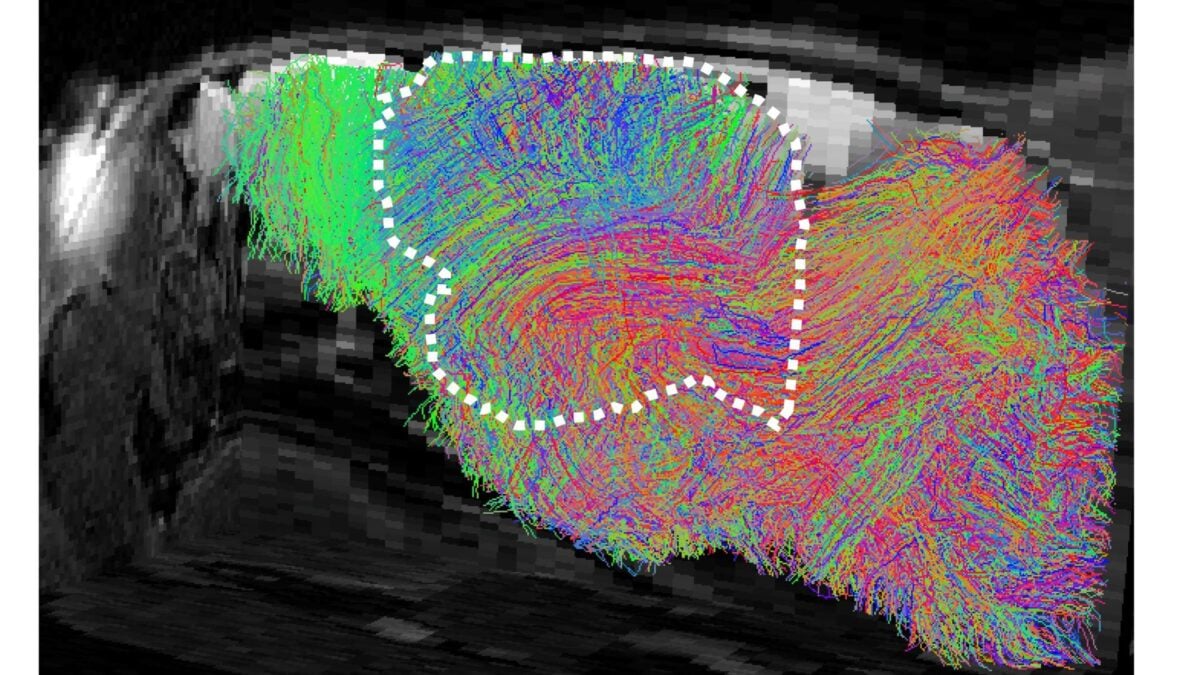 Scientists Grew More Human Brain Tissue in a Mouse Than Ever Before&mdash;and People Have Questions