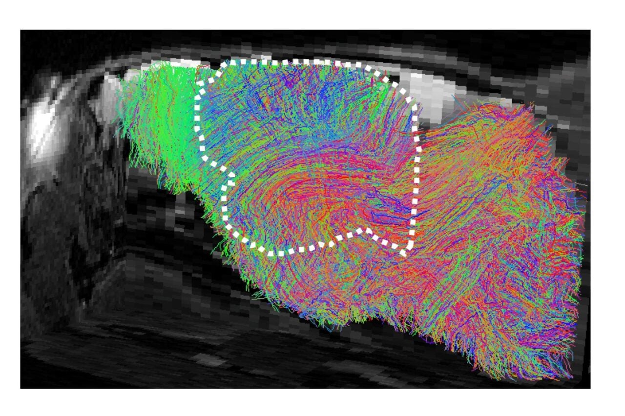 Scientists Grew More Human Brain Tissue in a Mouse Than Ever Before—and People Have Questions