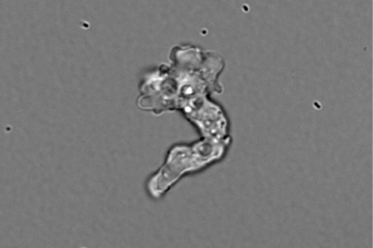 Say Hello to the ‘Fire Amoeba.’ It Just Broke a Heat Limit Scientists Thought Was Impossible