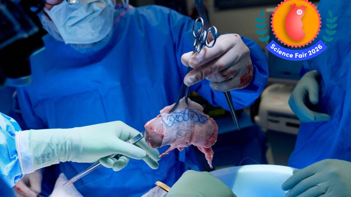 These Scientists Are Charting a New Future for Organ Transplantation&mdash;and It Starts With Pigs
