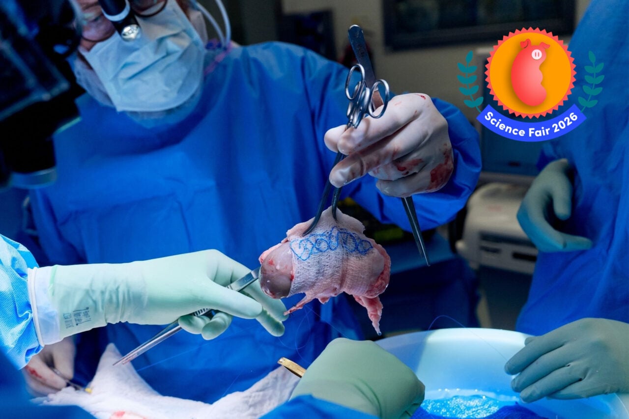 These Scientists Are Charting a New Future for Organ Transplantation—and It Starts With Pigs