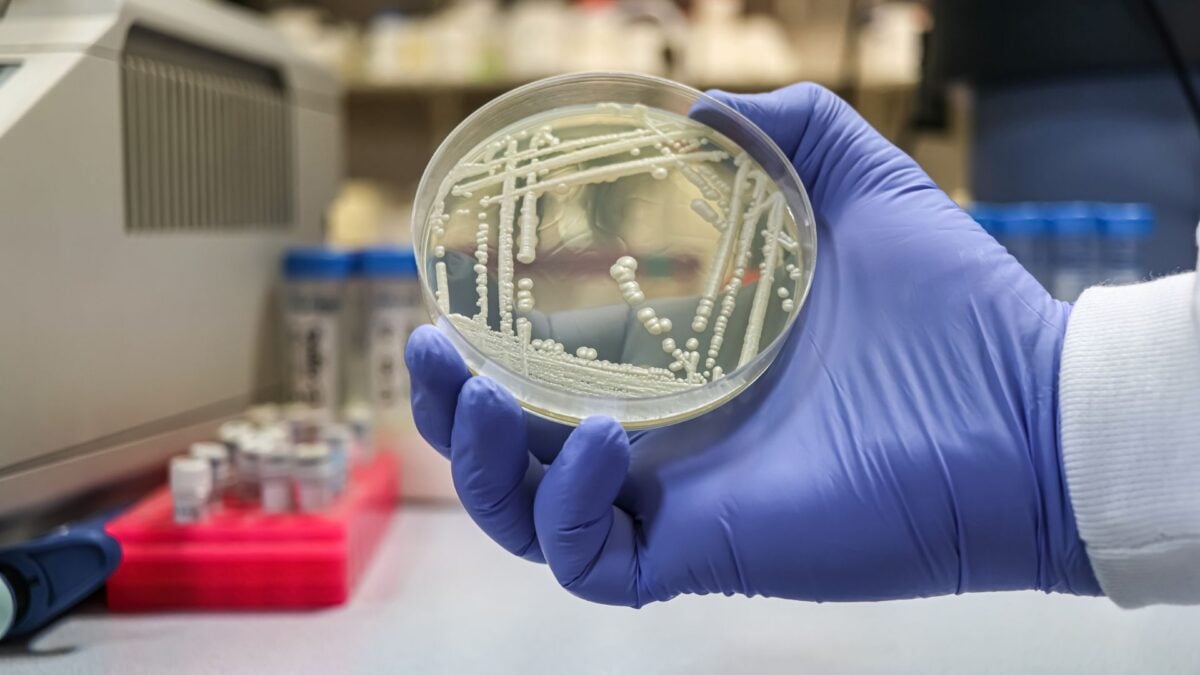 This Deadly Fungus Keeps Learning How to Beat Every Drug We Throw at It This Deadly Fungus Keeps Learning How to Beat Every Drug We Throw at It