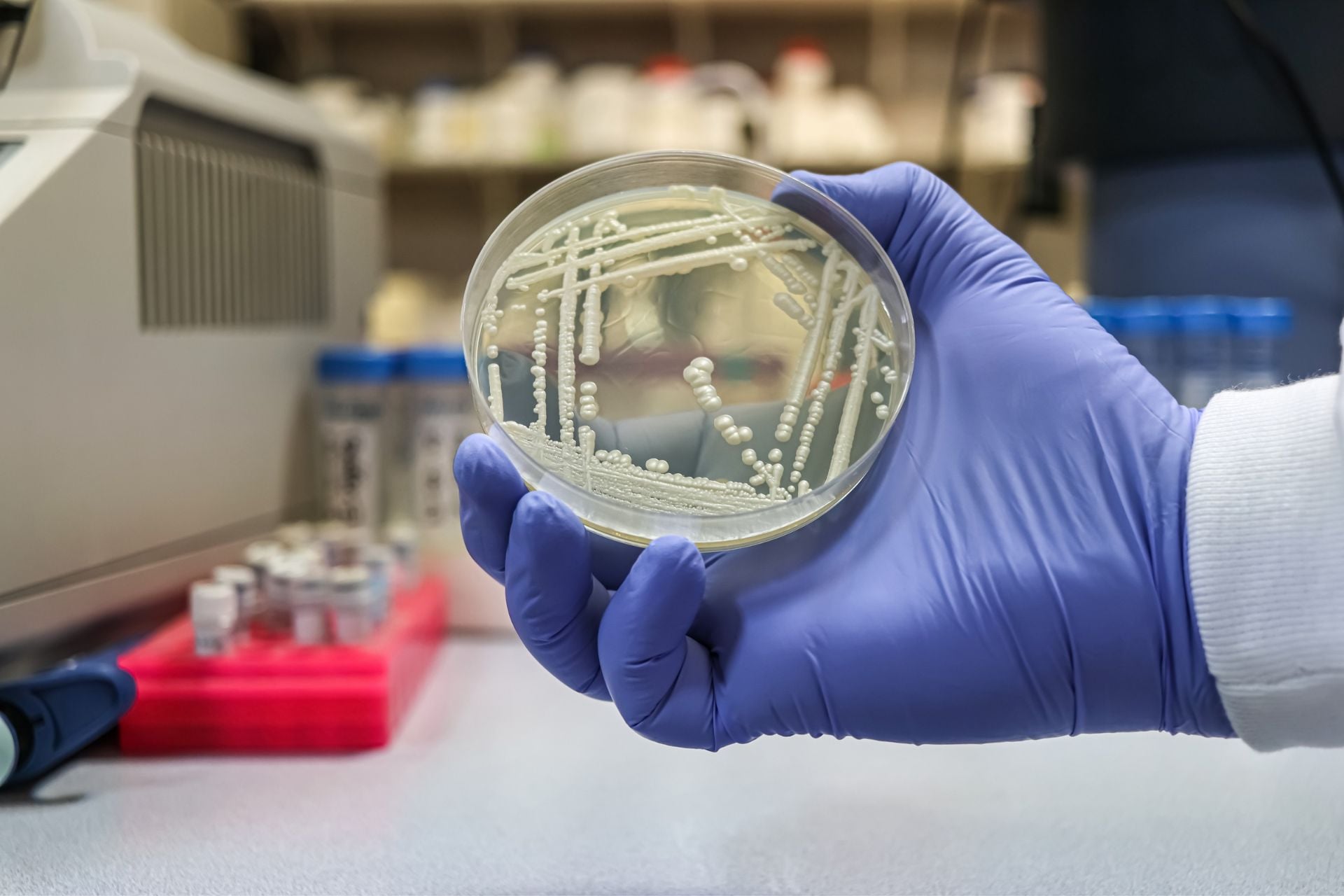 Kenyan Doctors Report First Fully Drug‑Resistant Candida auris Infection