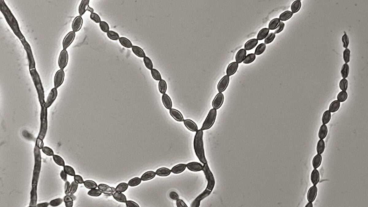 A Deadly Mold That Attacks the Brain Is on the Rise, and…