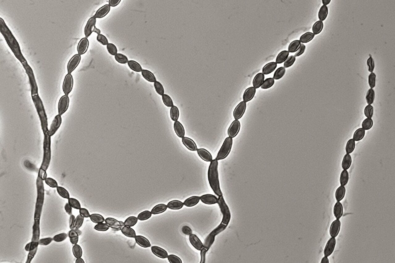 A Deadly Mold That Attacks the Brain Is on the Rise, and Scientists Aren’t Sure Why