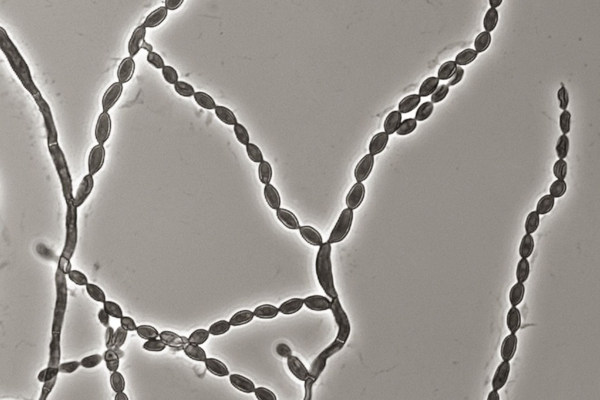 A slide culture of Cladophialophora bantiana, photographed in phase contrast microscopy. The fungus naturally produces melanin, which is responsible for its darkened appearance. 