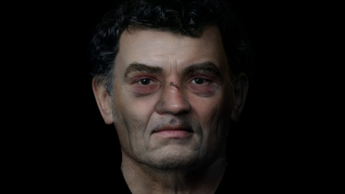 A Broken Nose, a Damaged Arm, and a Gruesome Grave. This Man From Roman Scotland Now Has a Face