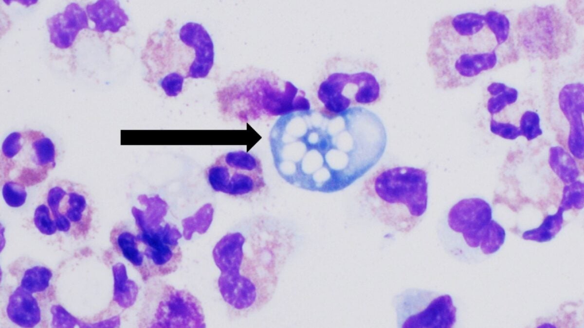 The Brain-Eating Amoeba Kills 97% of Its Victims. Scientists May Have Found a Way to Stop It in Hours