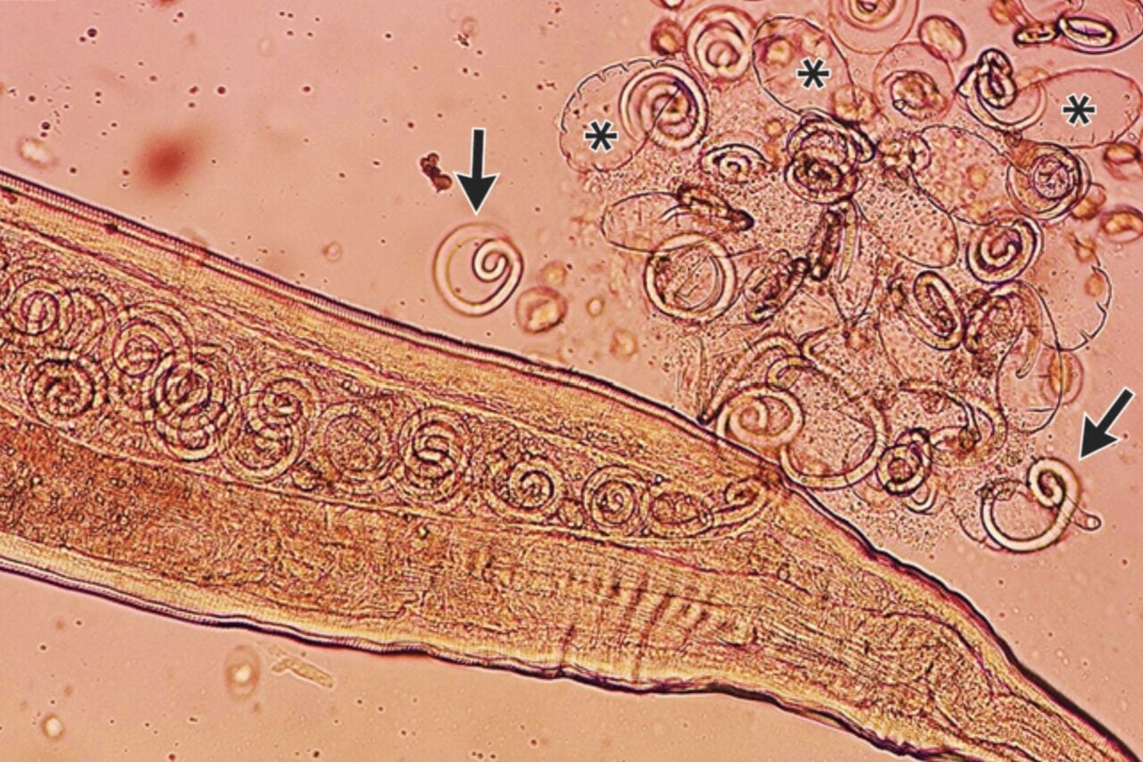 Thelazia Worms 2