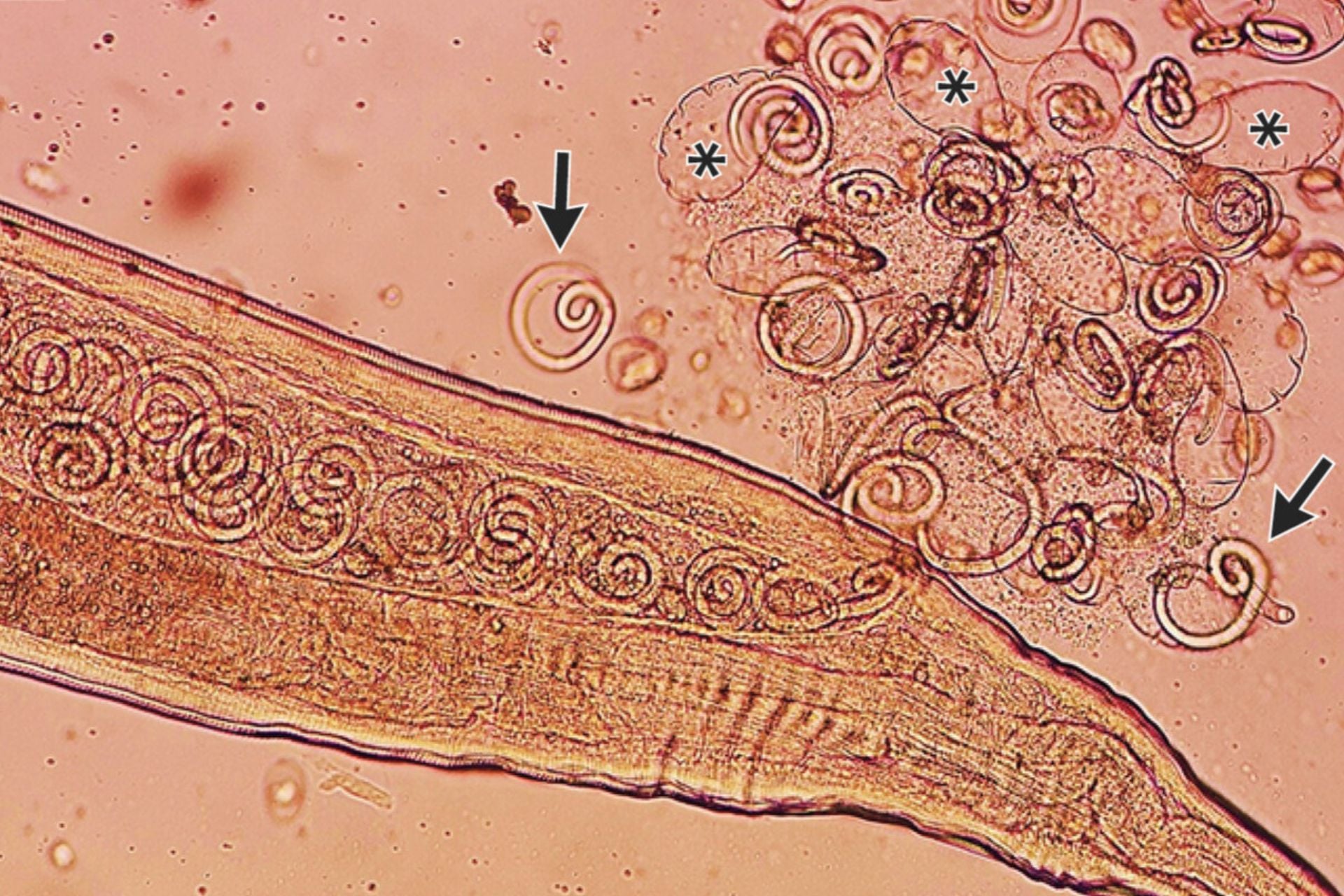Farmers' Cataract Operation Uncovers Live Worms, Some Already Laying Eggs
