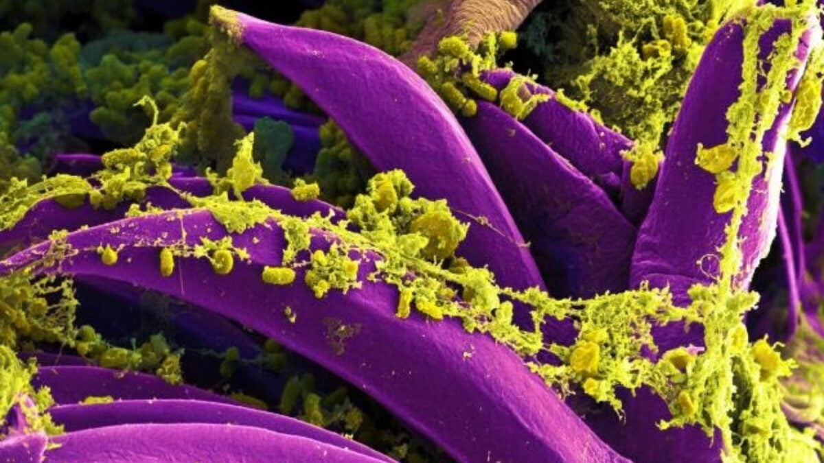 The Death of a Russian Plague Lab Worker Sounds Terrifying. How Worried Should You Be? The Death of a Russian Plague Lab Worker Sounds Terrifying. How Worried Should You Be?