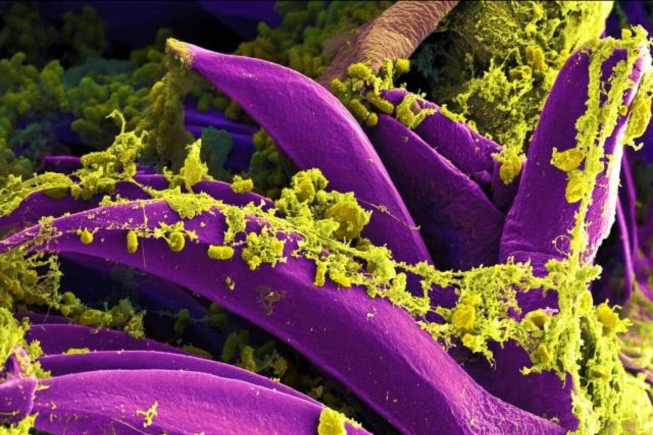 The Death of a Russian Plague Lab Worker Sounds Terrifying. How Worried Should You Be?