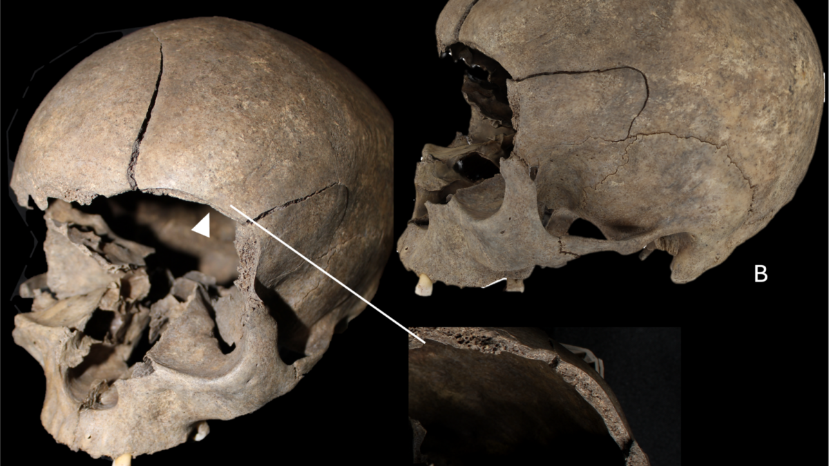 Iron and Viking Age Scandinavians Kept Their Victims’…