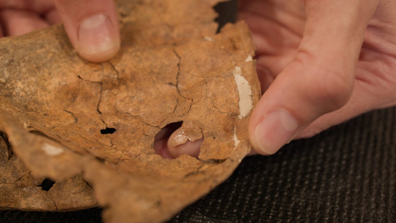 Scapula Shanidar A Close Up