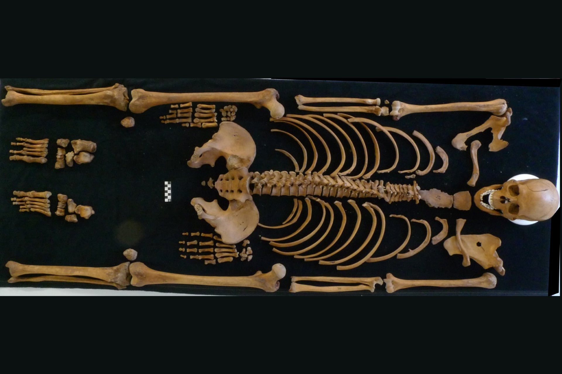 An overhead view of the skeleton.