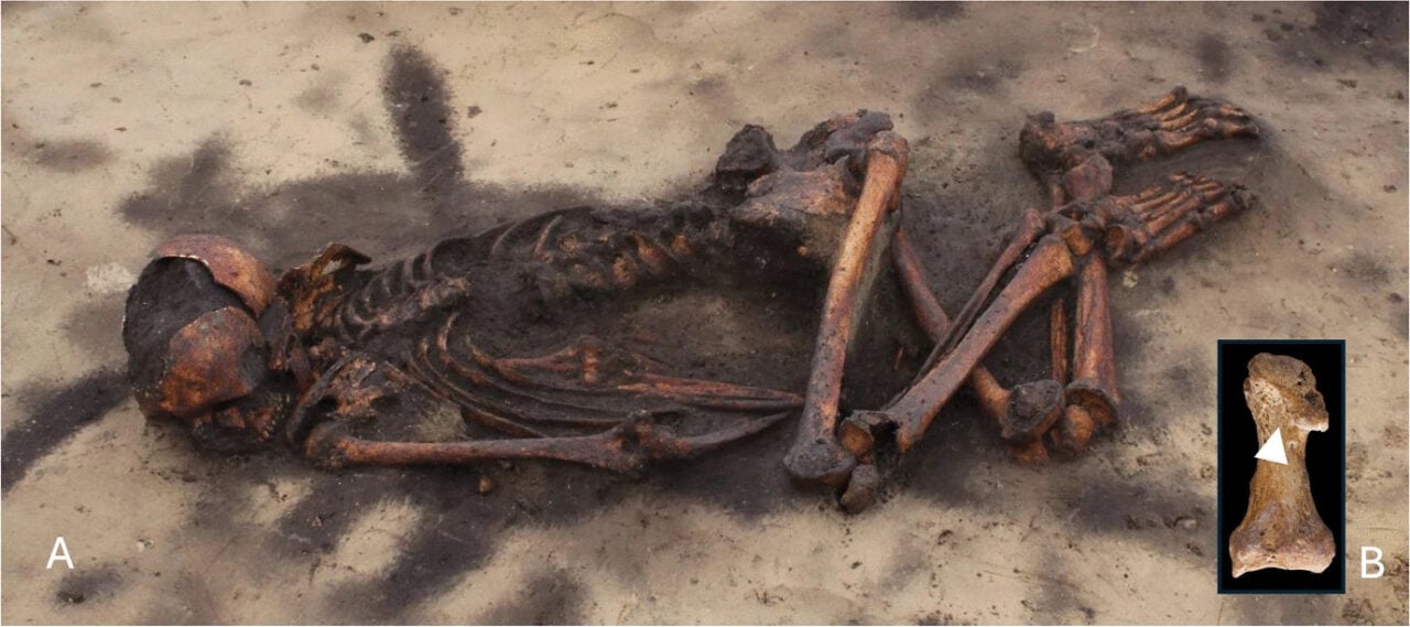 Viking Skeleton Trauma Body Politics